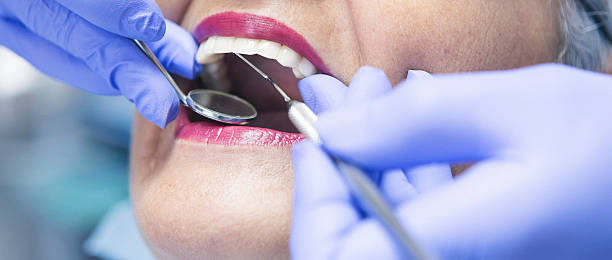 Best Emergency Wisdom Teeth Removal in Amherst, TX